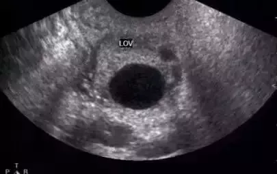 重慶送子鳥醫院