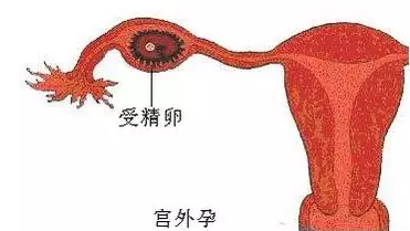 重慶送子鳥(niǎo)醫(yī)院