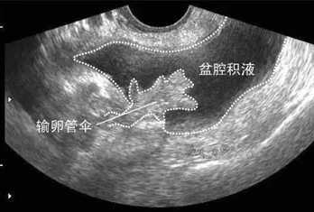 重慶送子鳥醫(yī)院